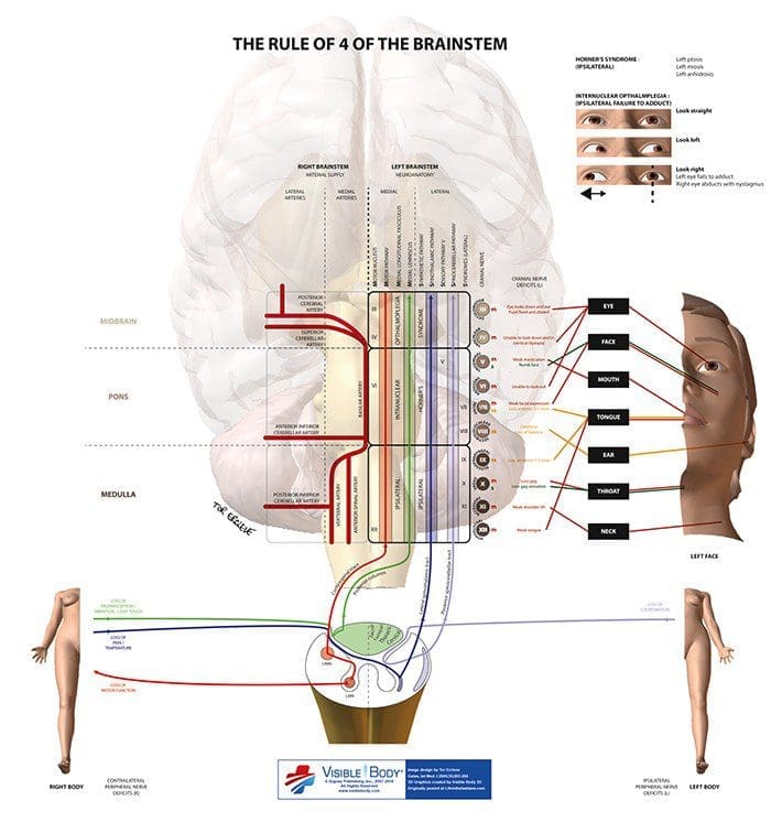 brainstem el paso tx.