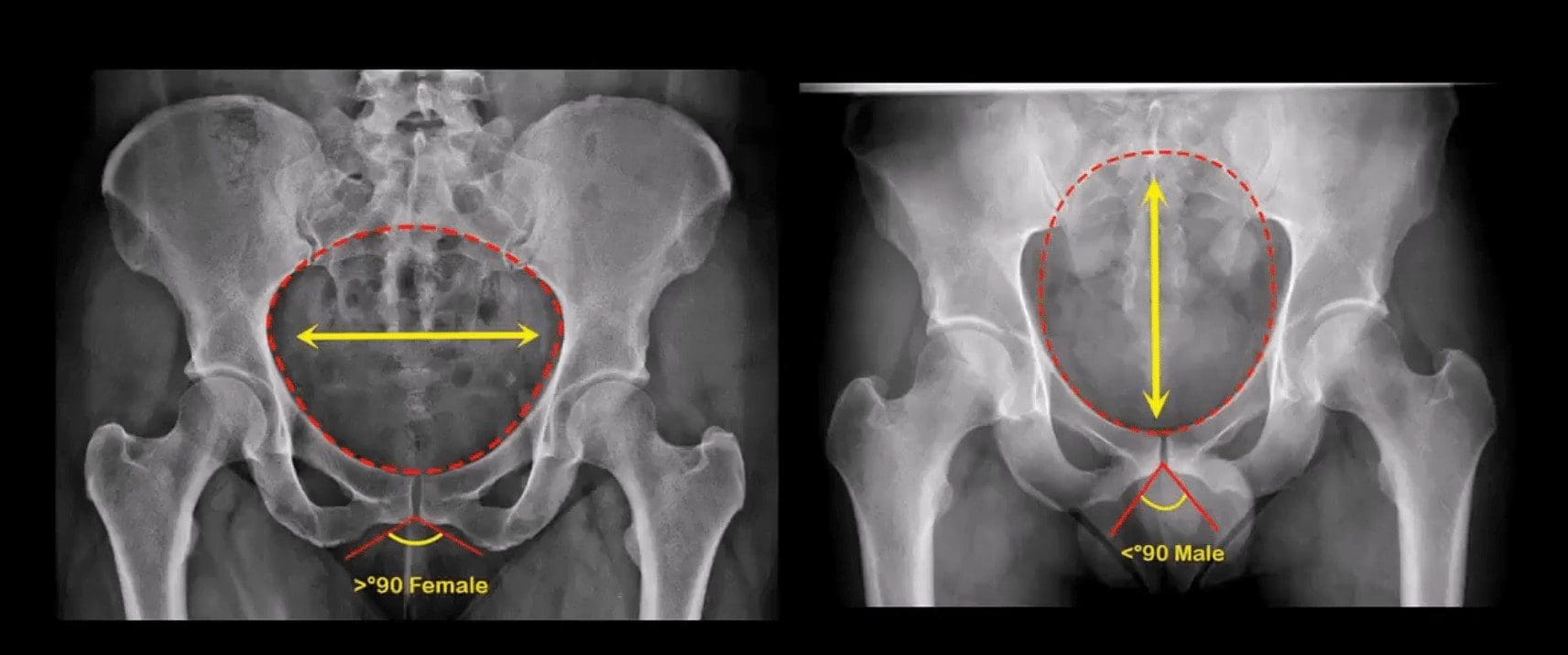 pelvis trauma el paso tx.