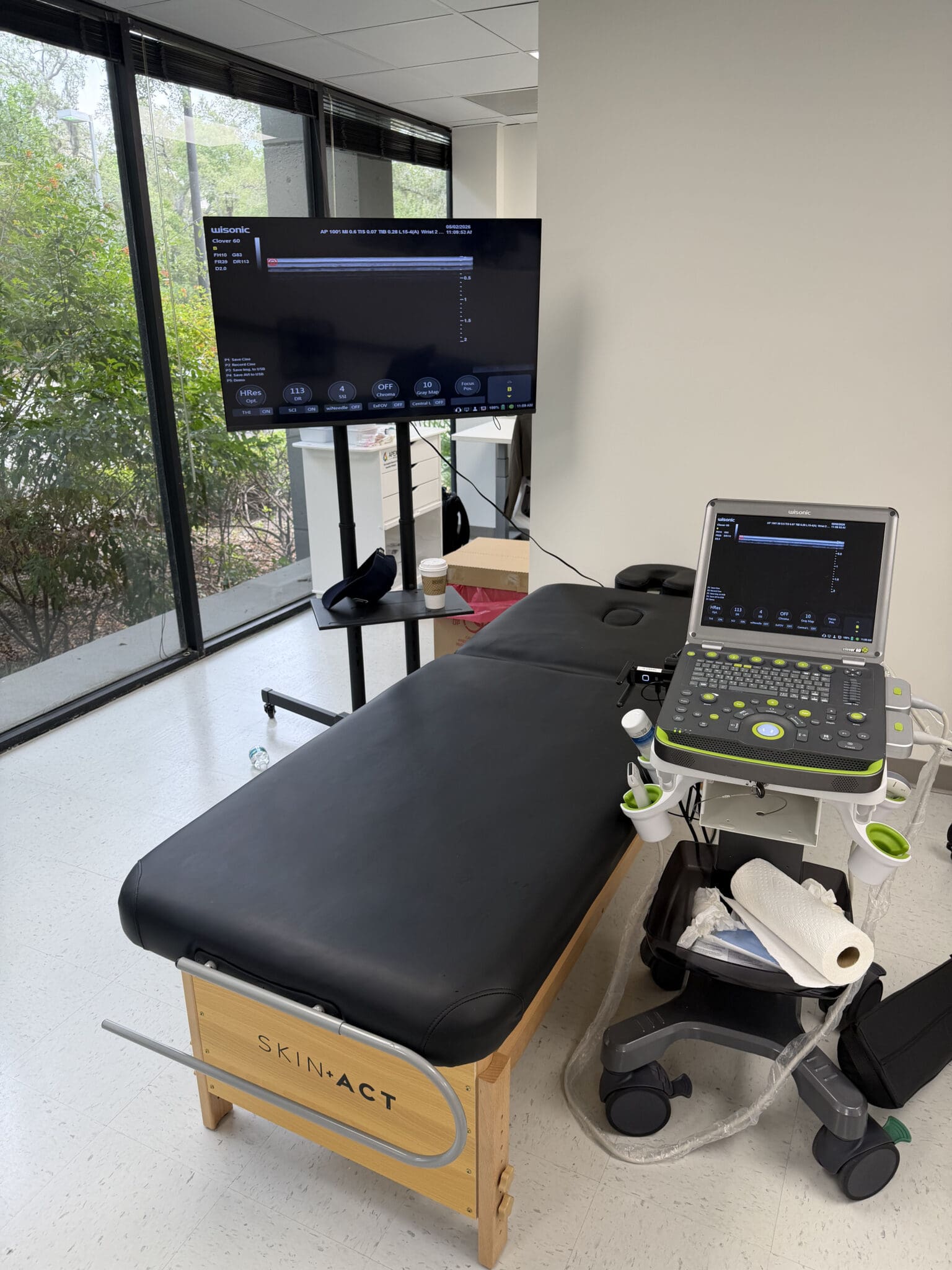 Ultrasound PRP for Hip Impingement Recovery Process