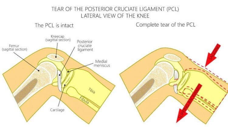 El Paso Dashboard Knee Trauma: Diagnosis and Recovery